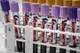 اجرای طرح غربالگری HIV و هپاتیت C در گرمخانه بانوان